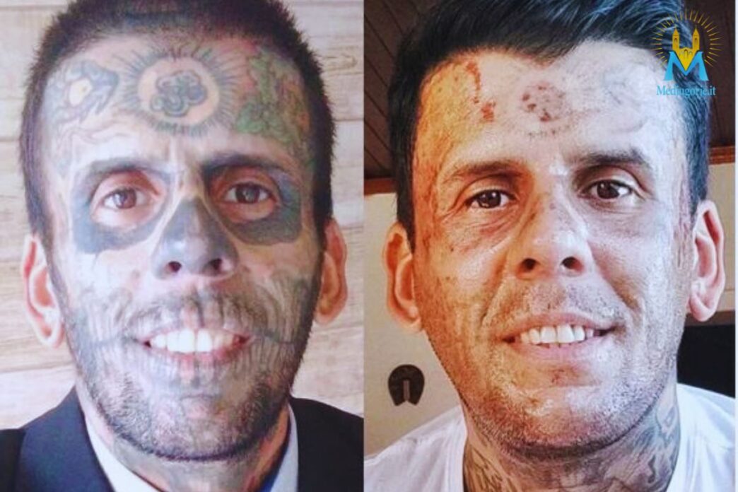 l'uomo che dopo la conversione ha rimosso i tatuaggi