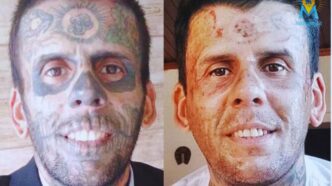 l'uomo che dopo la conversione ha rimosso i tatuaggi