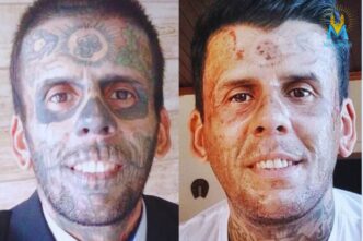 l'uomo che dopo la conversione ha rimosso i tatuaggi