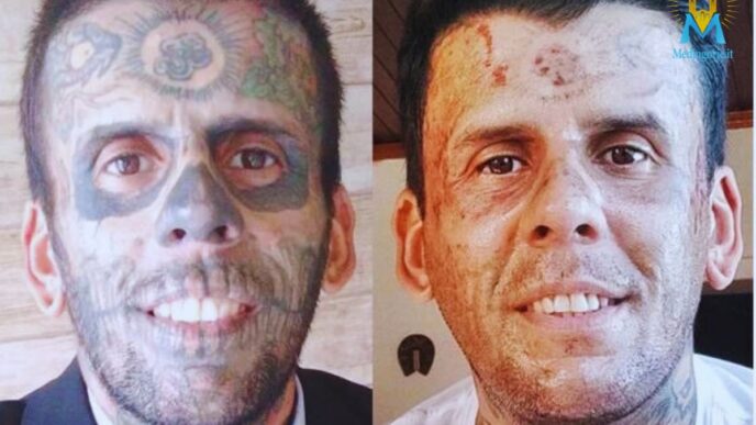 l'uomo che dopo la conversione ha rimosso i tatuaggi